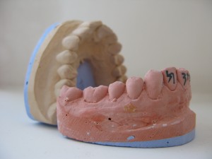 dentist-in-chandler-az-300x225